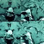 Especialista em neurocirurgia Belo Horizonte